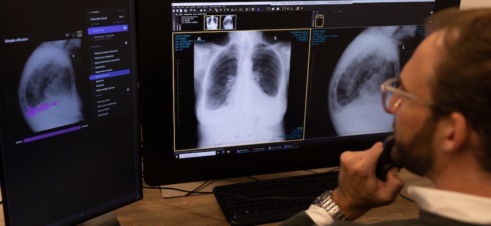 Chest X-ray AI solution which detects 124 clinical findings launched